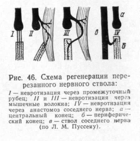 як лікувати розтягнення нерва