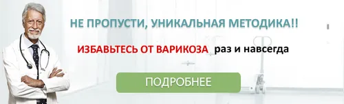 як вилікувати варикоз в паху