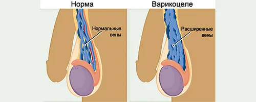пахової