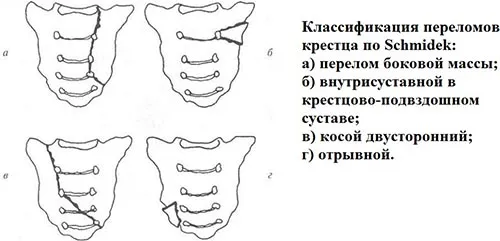 лікувати забій тазу