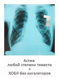 вилікувати астму без гормонів