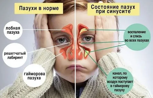ускладнення