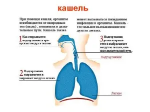 хронічний нежить і кашель