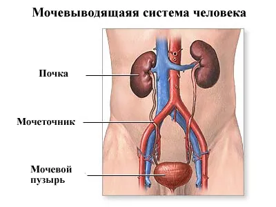 як лікувати ендометріоз сечового міхура