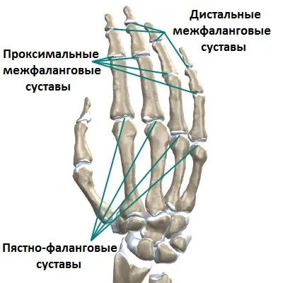 як лікувати суглоби кистей рук