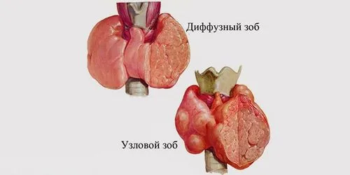 профілактика