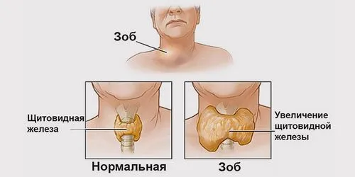 симптоми