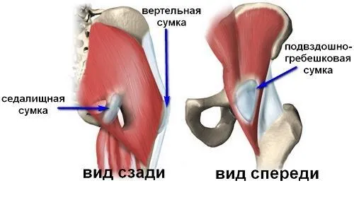 як лікувати бурсит плеча
