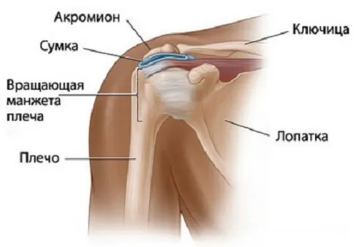 як лікувати бурсит плеча
