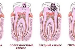 дантист будинку