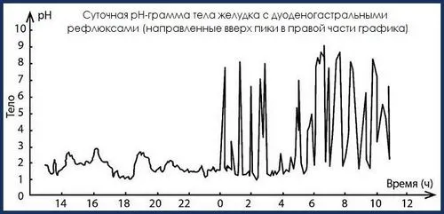 дуоденіт