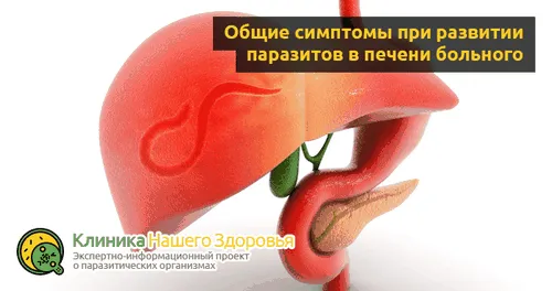 як лікувати глисти в печінці