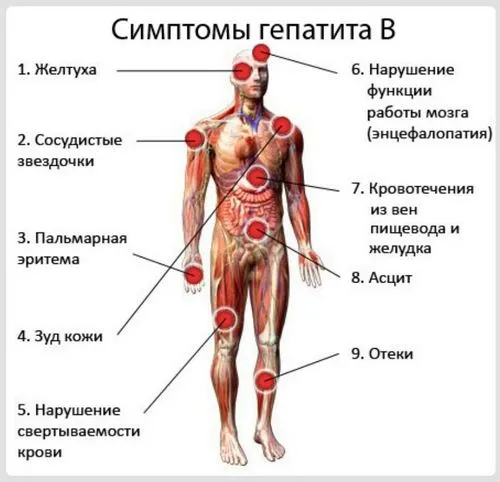 гепатит b діагностика