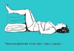 як лікувати радикуліт люмбаго