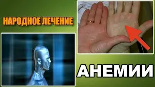 як можна вилікувати анемію народними засобами