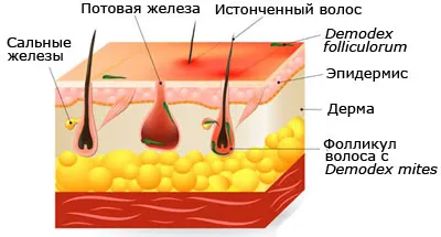Шкірний кліщ: причини, діагностика захворювання, лікування, фото як вилікувати кліщовий дерматит