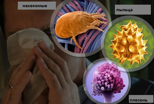 як лікувати цілорічний риніт
