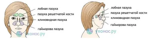 як лікувати кісту в гайморової пазухи