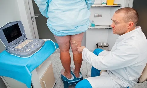 лікувати варикозне розширення вен мазі