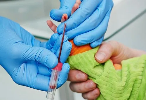 як лікувати кісту яєчка