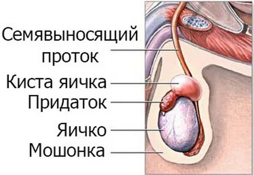 Кіста яєчка у чоловіків як лікувати кісту яєчка у чоловіків