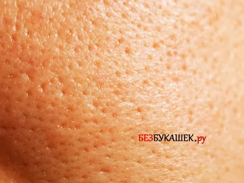 як лікувати підшкірний кліщ демодекс