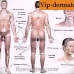 як лікувати вітіліго звіробоєм