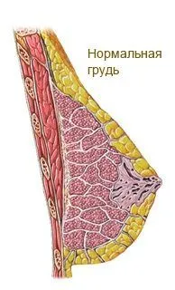 як вилікувати фіброзно кістозна мастопатію народними засобами