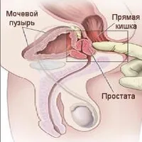 як вилікувати хламідіоз без антибіотиків
