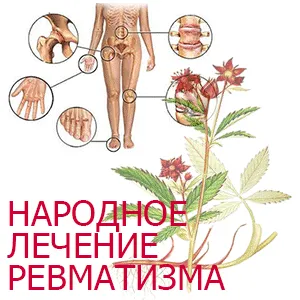 як лікувати ревматизм народними засобами
