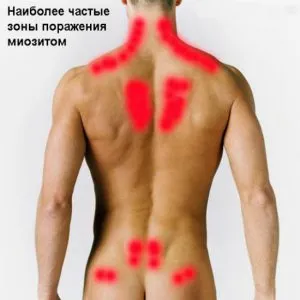лікування