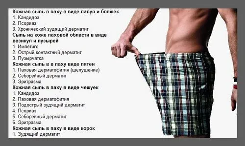 статеві органи