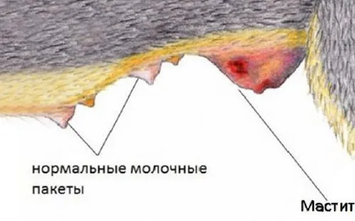 як лікувати запущений мастит