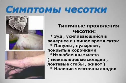 як лікувати повторну коросту