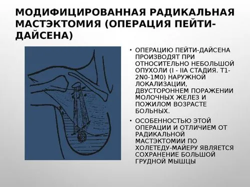 руки