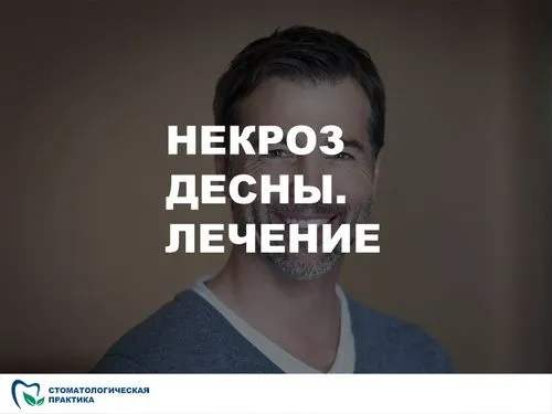 лікування ясен