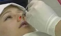 гострий і хронічний гайморит