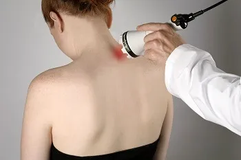 як лікувати остеохондроз 1 ступеня