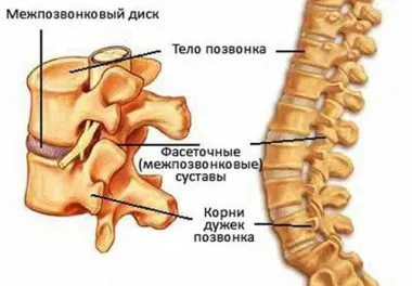 як лікувати остеохондроз другого ступеня