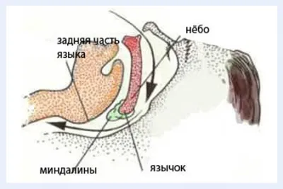як вилікувати хропіння хірургічним шляхом