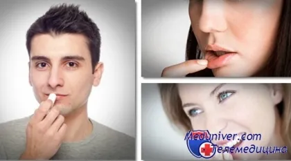 як лікувати заїди на губах