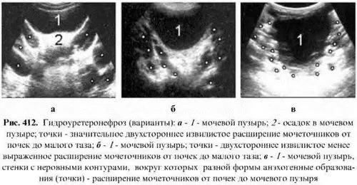 як лікувати розрив нирки