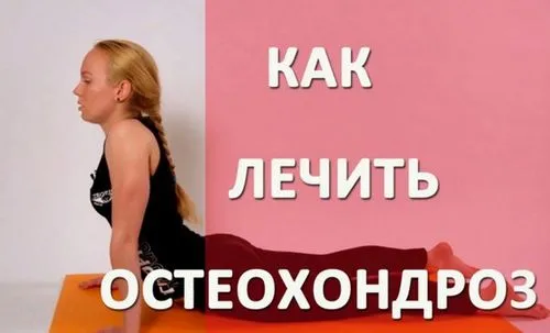 як лікувати остеохондроз в період загострення