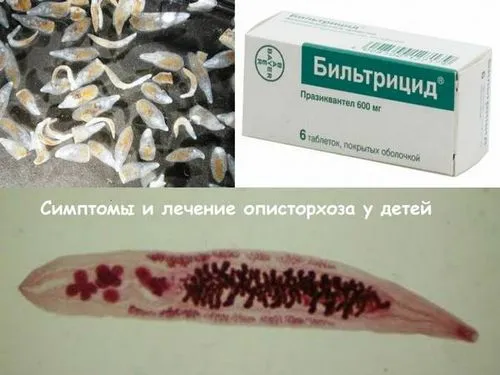 Опісторхоз у дітей: симптоми і лікування небезпечного захворювання опісторхоз діти лікування симптоми гельмінт паразит препарати ліки причини зараження