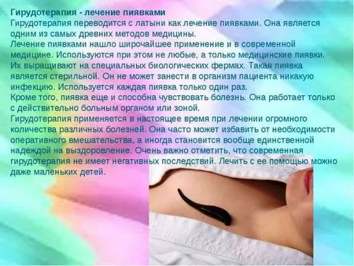 як лікувати мастопатію п'явками