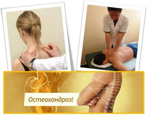 як лікувати остеохондроз в період загострення