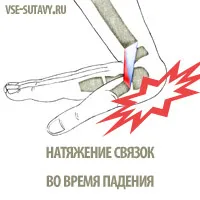 розтягнення зв'язок лучезапястного суглоба симптоми лікування