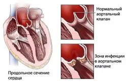 кардіолог будинку