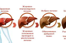 перший по печінці