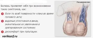 Розширення вен статевого члена: причини, лікування як вилікувати варикоз в паху